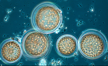 Kasviplankton1.jpg